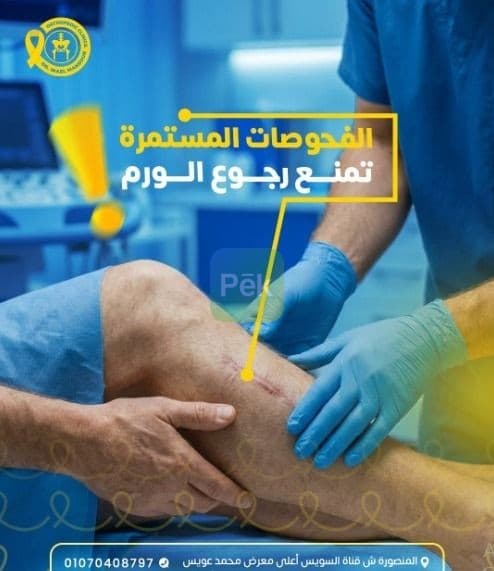 دكتور جراحه اورام العظام في المنصوره - جراحه دقيقه