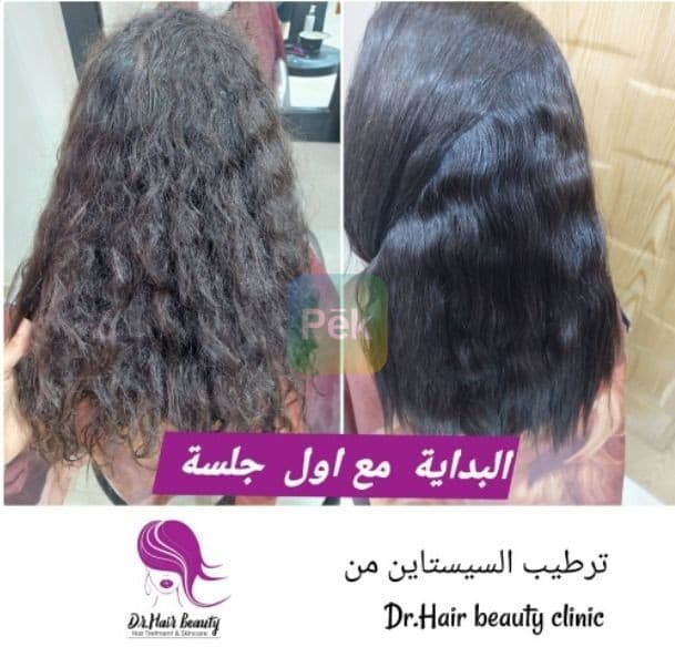 مركز لعلاج و فرد الشعر بشبين الكوم - خبره 11 سنه