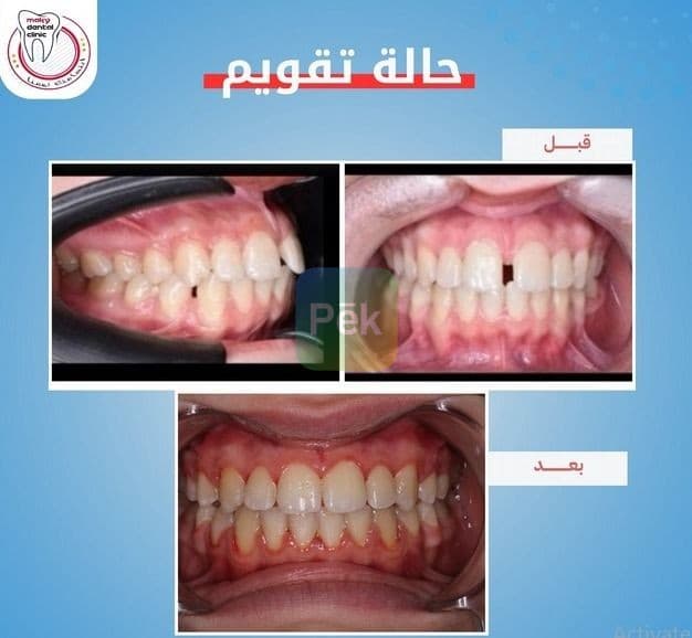 طبيب لتقويم الاسنان بسوهاج - ابتسامه اكثر ثقه